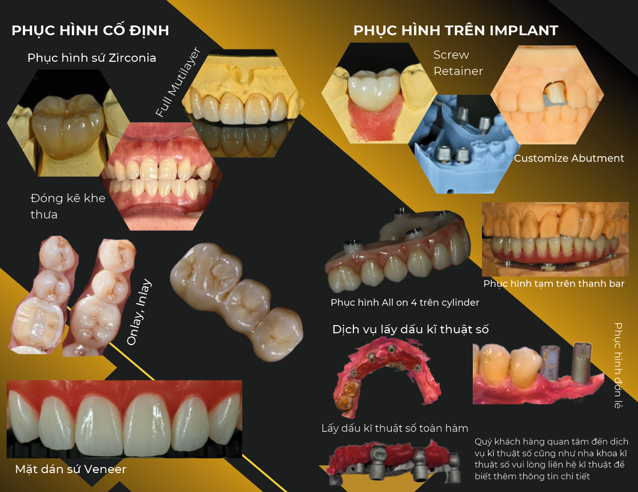 VÌ SAO CHỌN CHÚNG TÔI