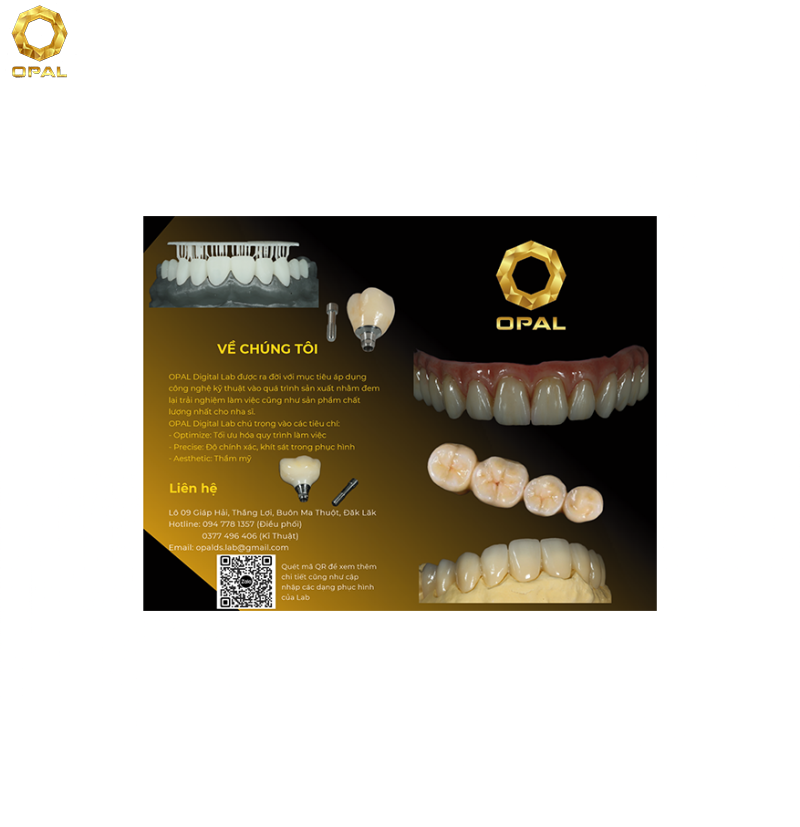 Giới Thiệu Về Opal Digital Lab